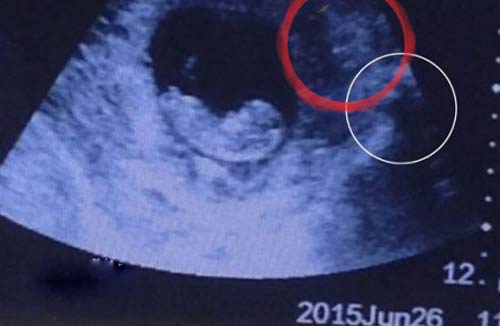 در شکم این زن باردار یک شیطان زندگی می کند! +عکس