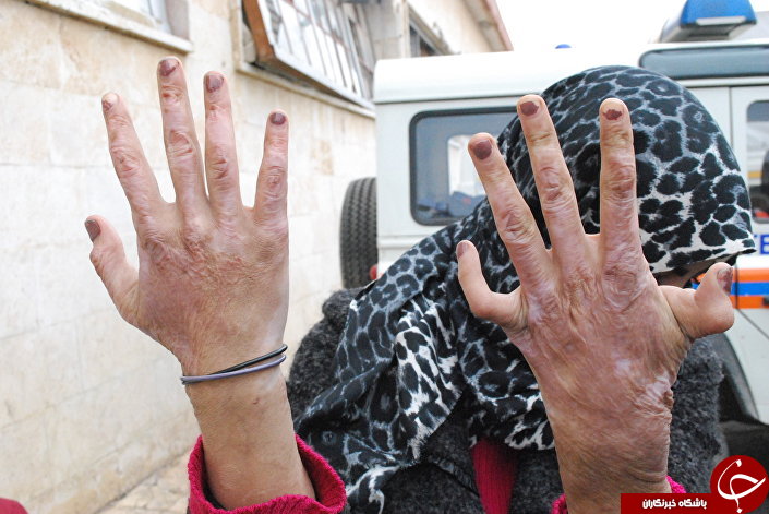 کاری که تروریست‌ها با زنان شهر حلب می‌کردند + تصاویر