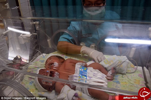 تولد نادر یک نوزاد 2 سر در اندونزی+تصاویر