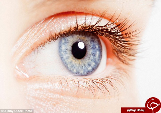 چشم قشنگ‌ها بیشتر در معرض خطر سرطان چشم هستند +تصاویر