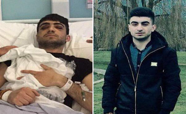 انتشار تصویری از وضعیت نوجوان ایرانی قربانی حمله نژادپرستانه در لندن