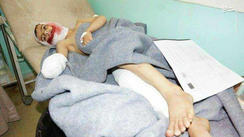 کودکانی که سعودی‌ها اعضای بدنشان را قطع کردند+عکس