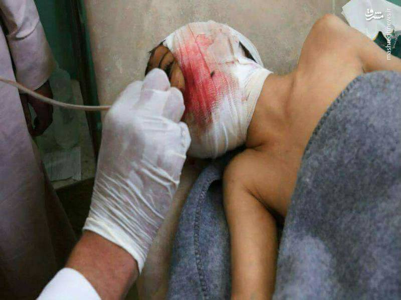 کودکانی که سعودی‌ها اعضای بدنشان را قطع کردند+عکس