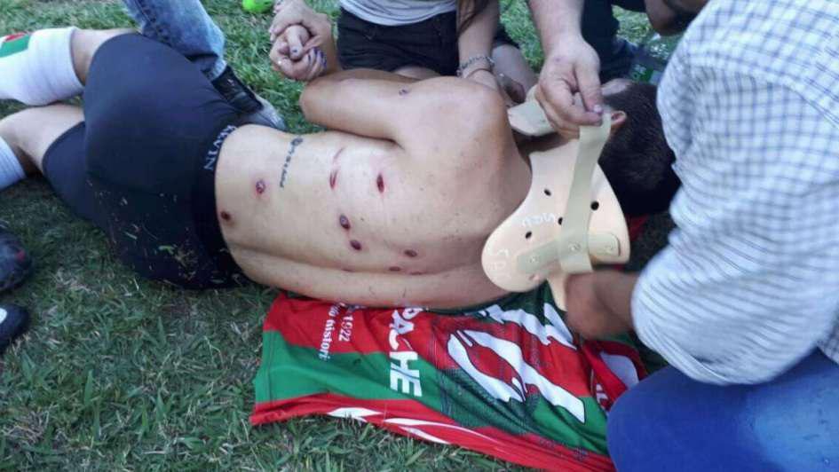 پلیس، فوتبالیست های آرژانتینی را وحشیانه به گلوله بست