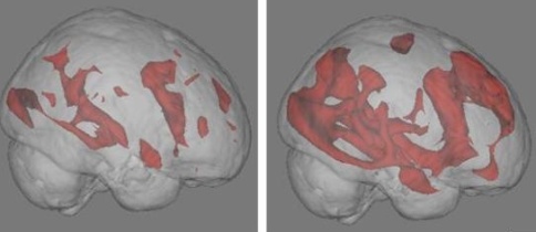MRI گرفته شده از مغز انسان